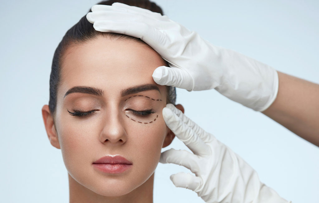 Augenlidstraffung Heilbronn